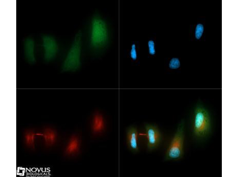 Read more about the article Novus畅销自噬产品精。篖C3 Antibody