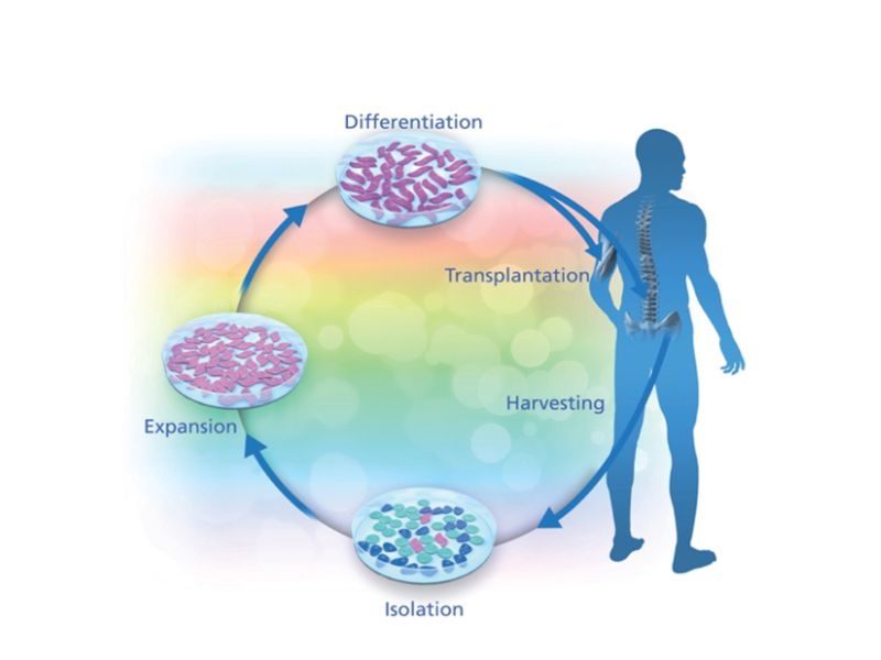 Read more about the article PeproTech 助力肌萎缩性侧索硬化（ALS）研究