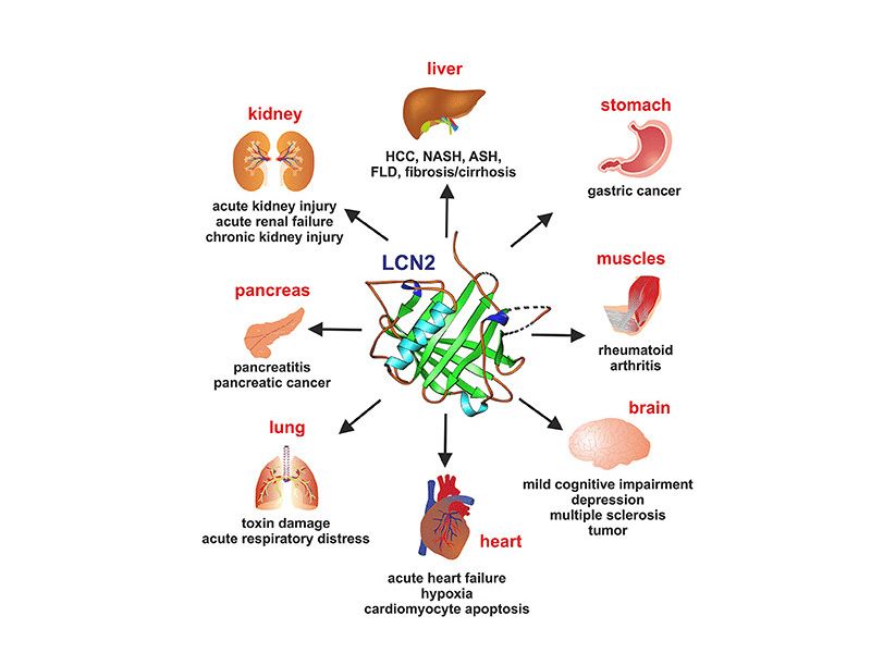 Read more about the article 不可不知的Lipocalin-2基因